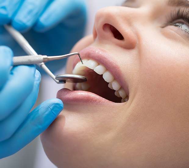 Pearland Dental Bonding