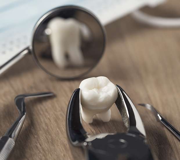 Pearland When Is a Tooth Extraction Necessary